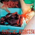 EXCREMENT / HIPERMENORREA - Surgical Exorcism - Split CD